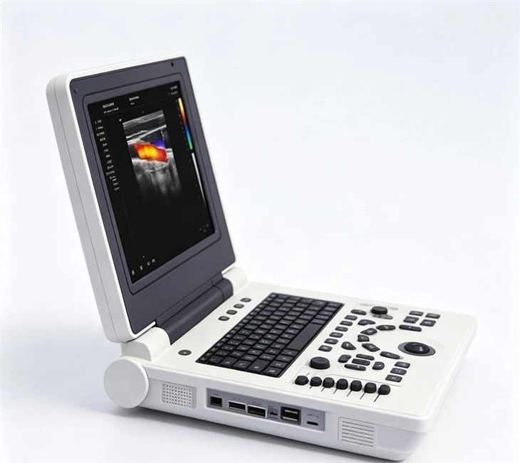 Ultrasound Scanner System price
